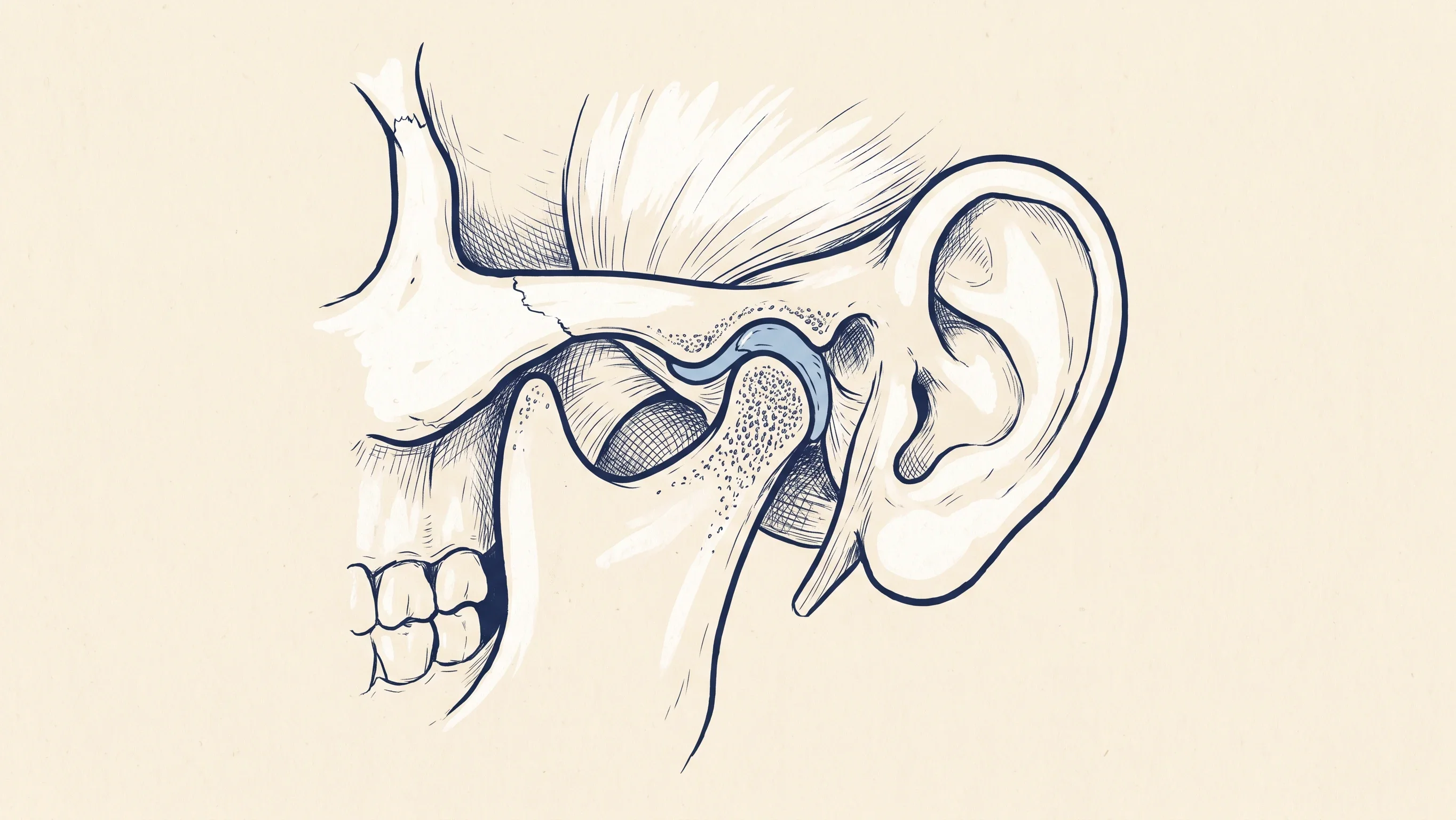 Line illustration of the temporomandibular joint, showing where the lower jaw meets the skull just in front of the ear, with the cushioning disc highlighted.