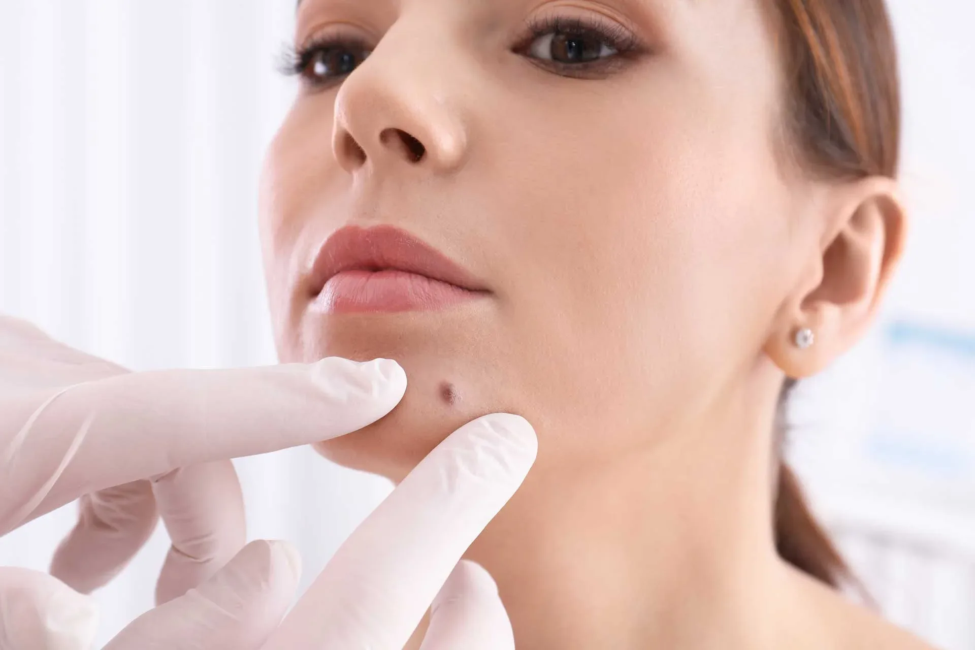 Non-melanoma skin cancer surgery — clinical reference