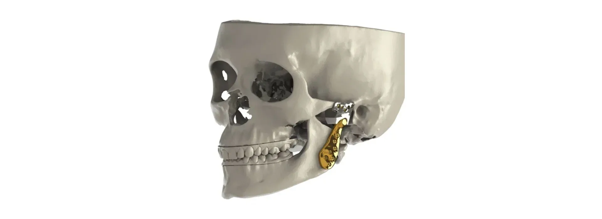 Jaw cysts and tumours — clinical reference