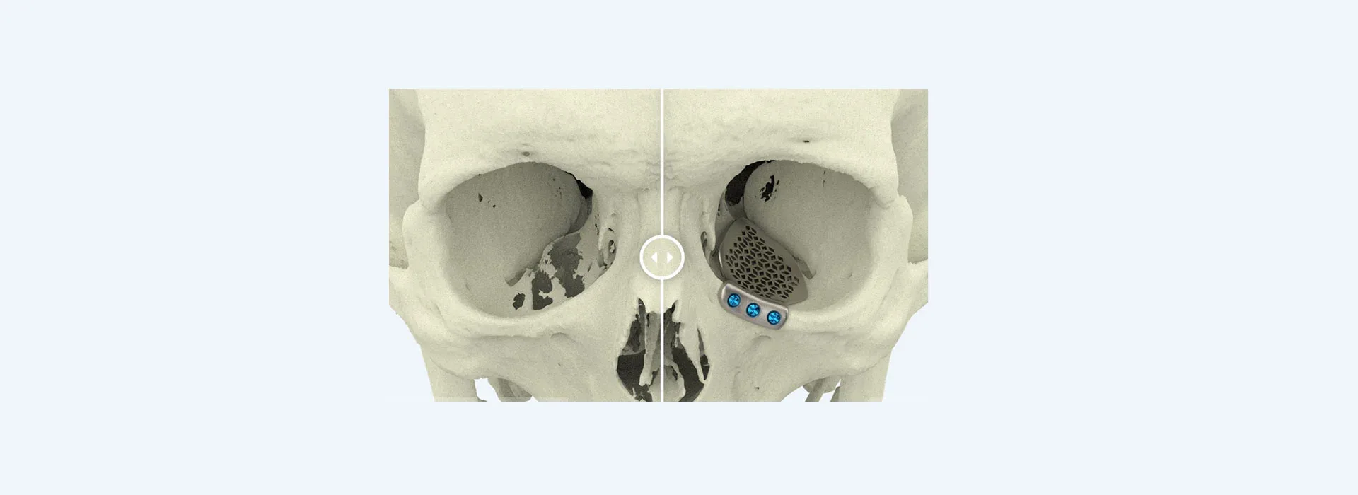 Salivary gland surgery — clinical reference